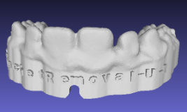 Bracket Removal - AFTER