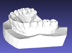 Full Palate Models for study models or Hawley retainer fabrication