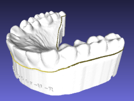 Theroux Retainer - full palate, for hand finishing