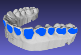 Bleach Tray with user-defined pockets