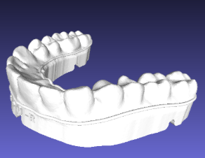 Retainer - shown with embossed trim path